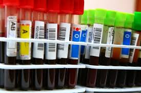 this image shows several test tubes filled with blood samples in a stand