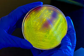 this image shows a lab petra dish and bacteria