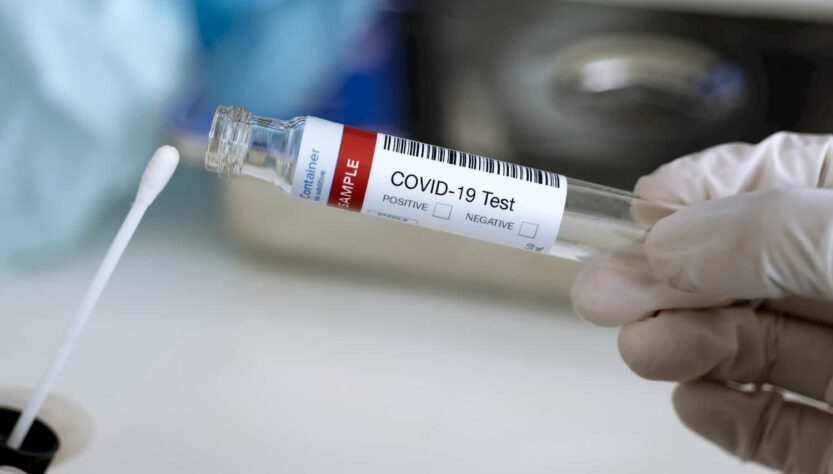 This image shows a covid test bottle and stick