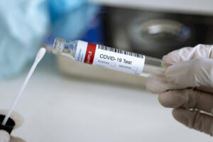 This image shows a covid test bottle and stick